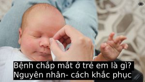 Bệnh chắp mắt ở trẻ em là gì? Nguyên nhân- cách khắc phục