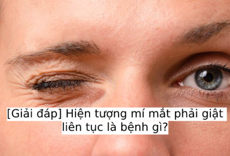 [Giải đáp] Hiện tượng mí mắt phải giật liên tục là bệnh gì?