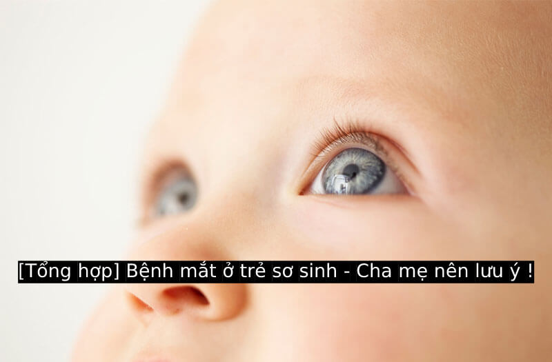 [Tổng hợp] Bệnh mắt ở trẻ sơ sinh - Cha mẹ nên lưu ý !