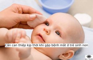 [SOS] Cần can thiệp kịp thời khi gặp bệnh mắt ở trẻ sinh non