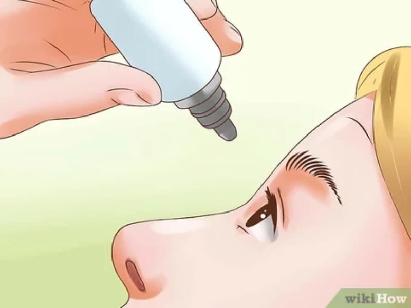 điều trị ruồi bay ở mắt không nên lạm dụng thuốc 