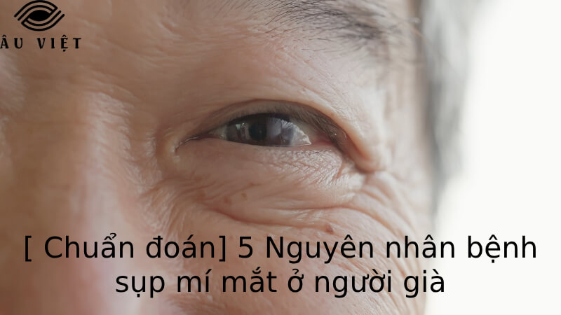 [ Chuẩn đoán] 5 Nguyên nhân bệnh sụp mí mắt ở người già