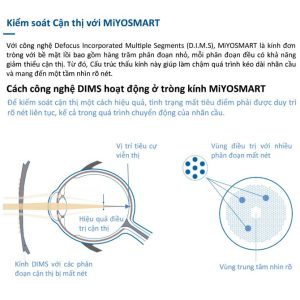 Tròng Kính MiYOSMART 1.59 Chameleon Photochromic & HOYA Full Control