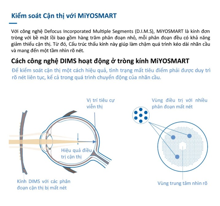 Tròng Kính MiYOSMART 1.59 Chameleon Photochromic & HOYA Full Control